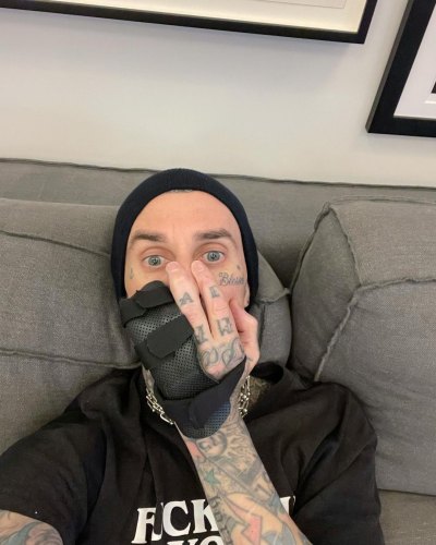 Travis Barker surgery