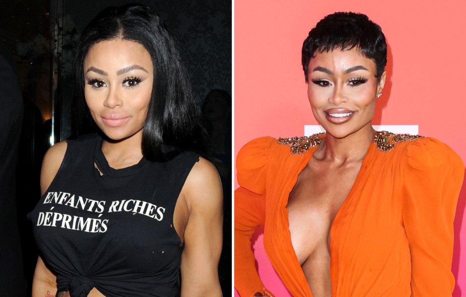 Has Blac Chyna Gotten Plastic Surgery? What She's Said Over the Years About Going Under the Knife