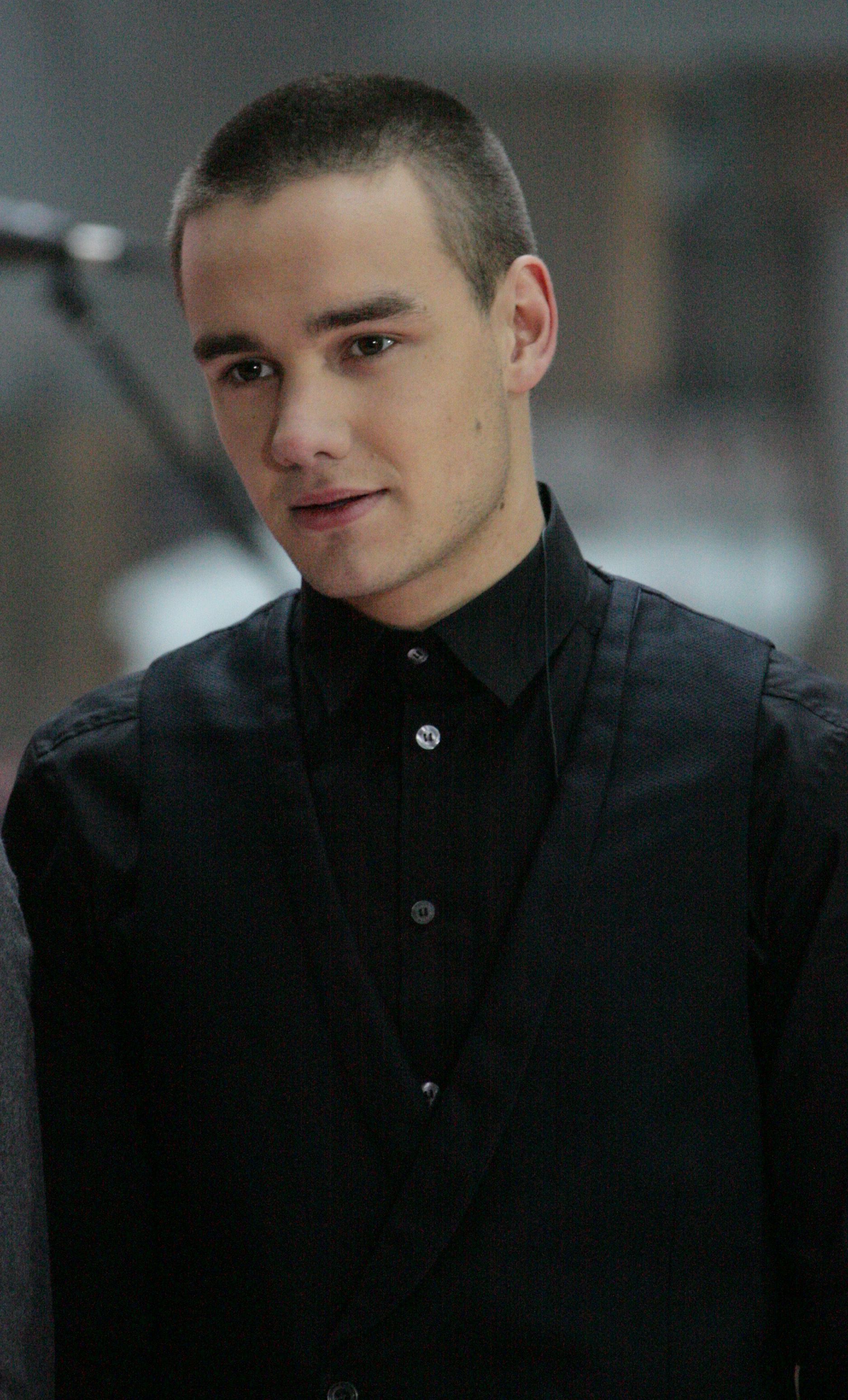 Did Liam Payne Get Plastic Surgery? Jaw, Face Photos