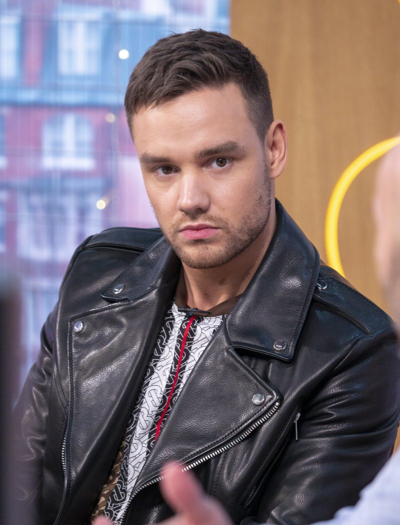 Did Liam Payne Get Plastic Surgery? Jaw, Face Photos