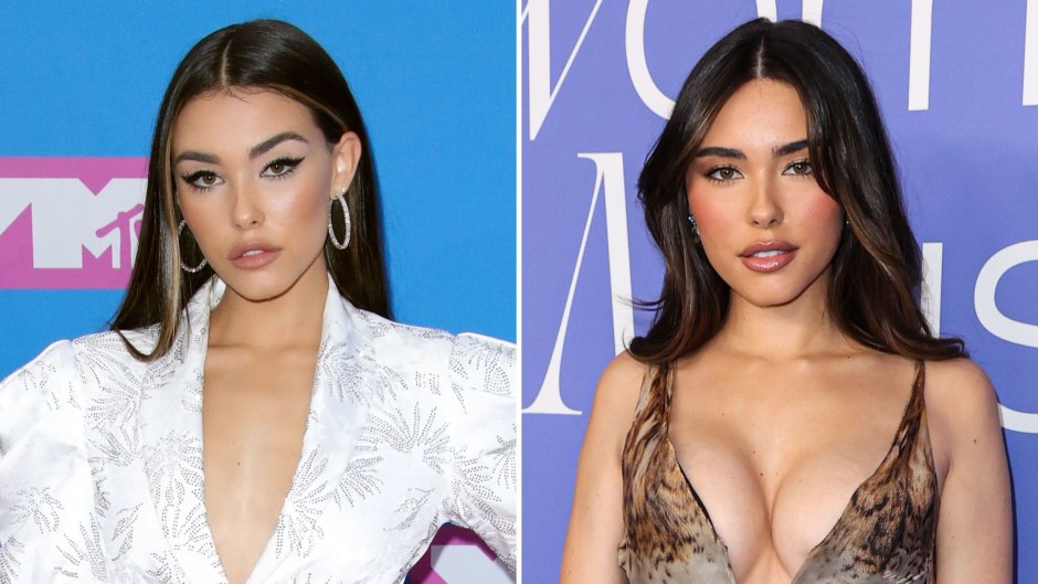 Madison Beer Has Addressed Plastic Surgery Rumors Over the Years: See Before, After Photos