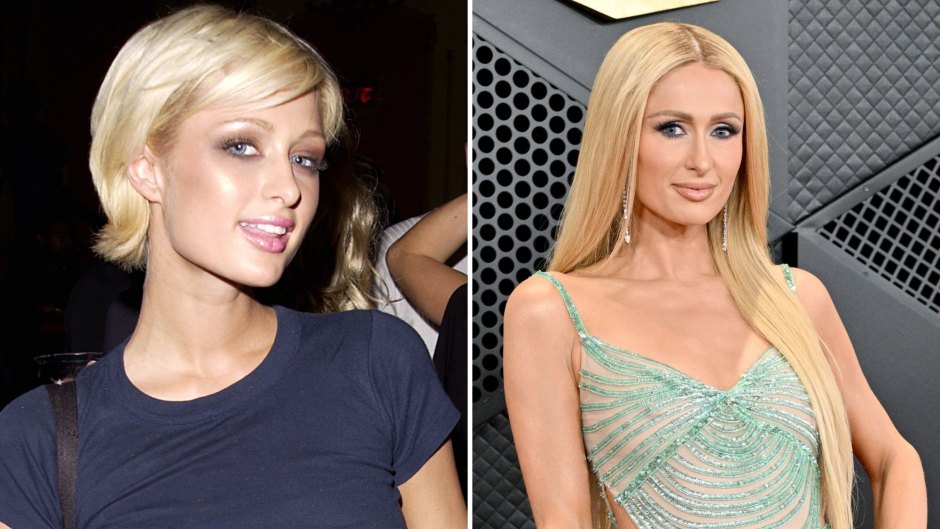 Cosmetic Work nan Heiress Had Done