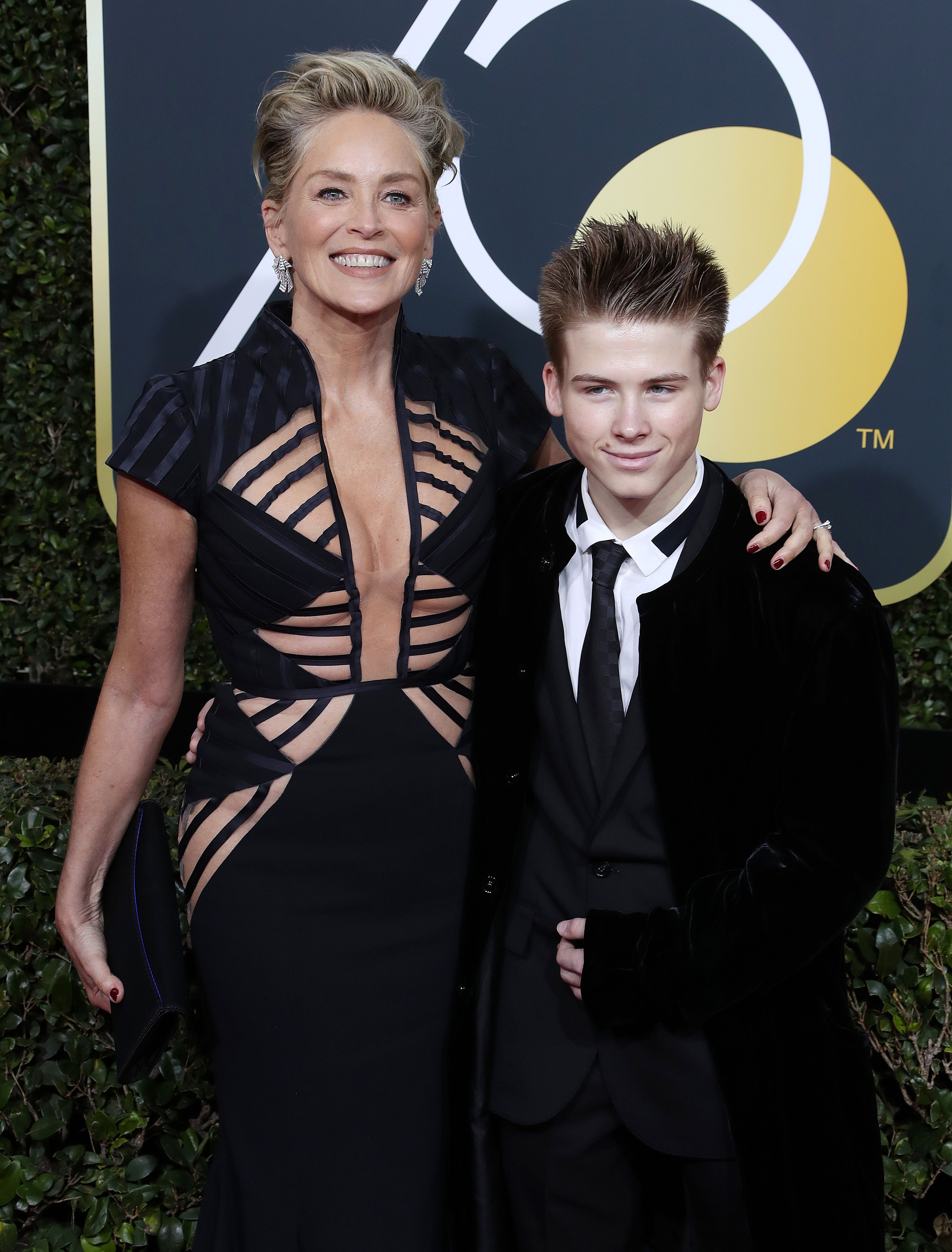 Sharon Stone Plastic Surgery