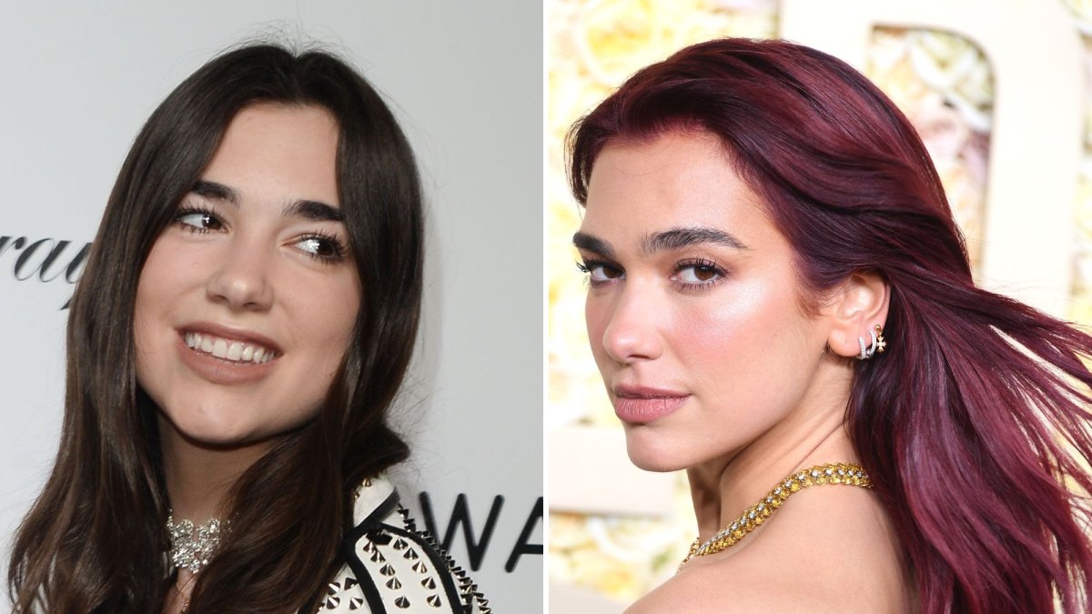 Did Dua Lipa Get Plastic Surgery? Transformation Photos