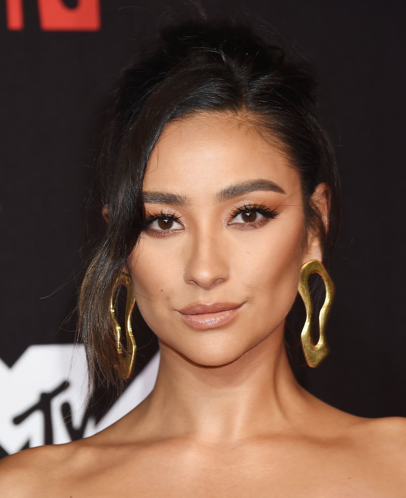 shay mitchell plastic surgery