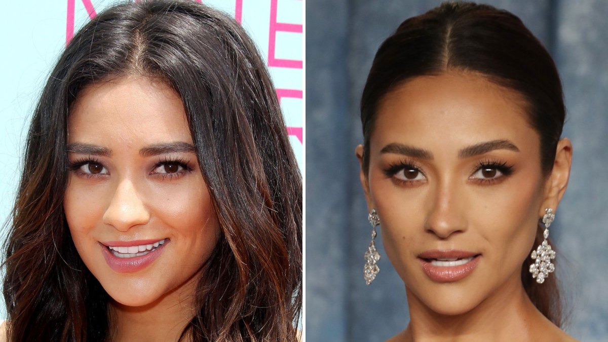 shay mitchell plastic surgery