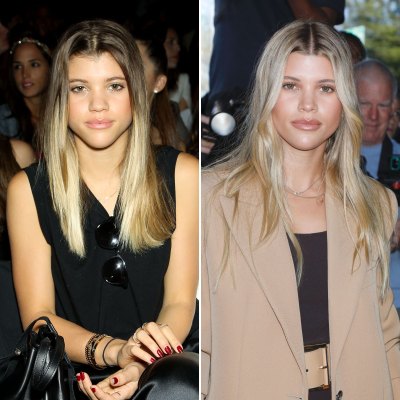 Did Sofia Richie Get a Nose Job? See Her Transformation Photos Amid Plastic Surgery Rumors