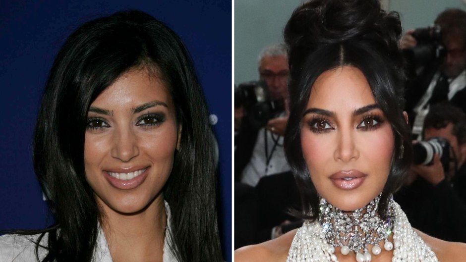 Kim Kardashian Before And After: Plastic Surgery Timeline | Life & Style
