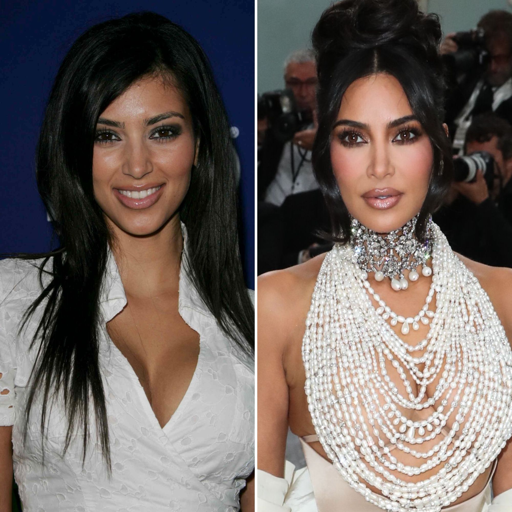 Kim Kardashian Before And After: Plastic Surgery Timeline | Life & Style
