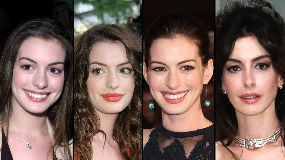 Has Anne Hathaway Had Plastic Surgery