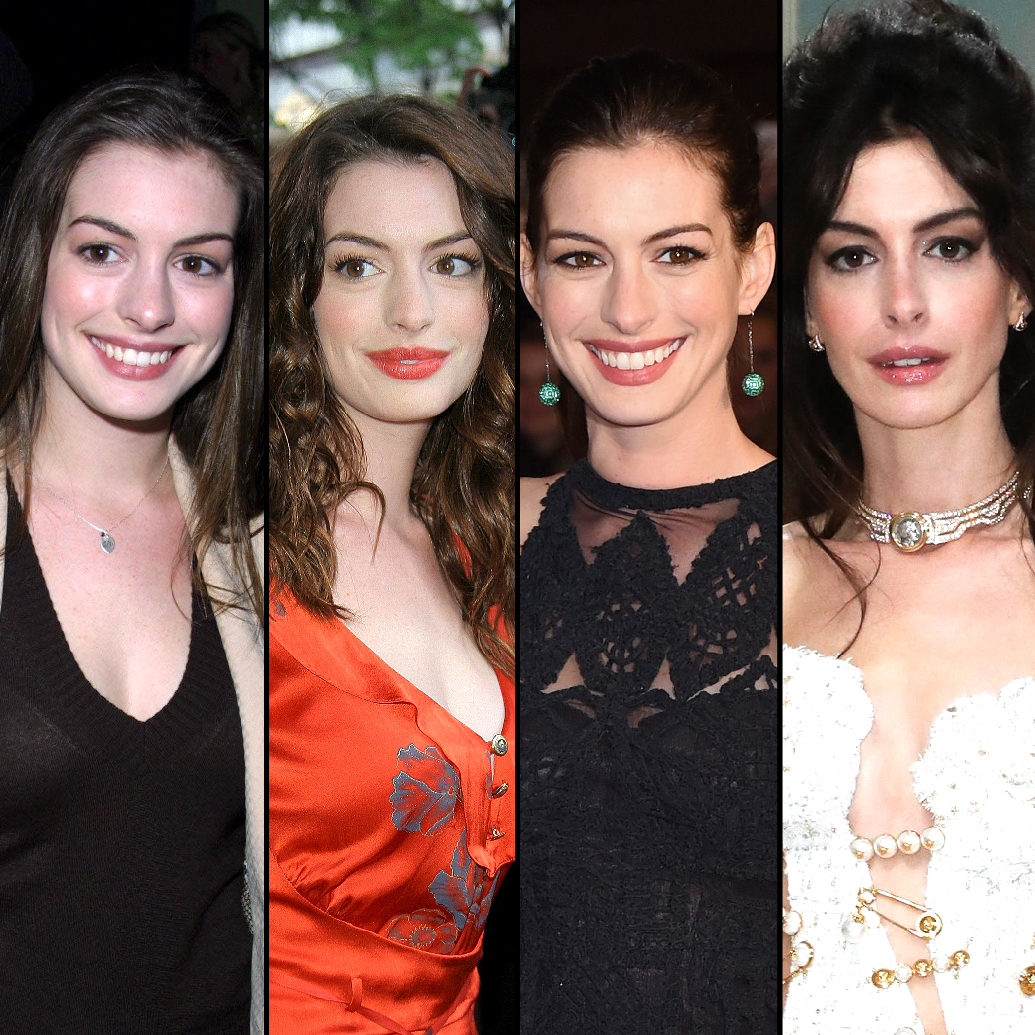 2100px x 2100px - Anne Hathaway Plastic Surgery: Transformation Photos, Quotes