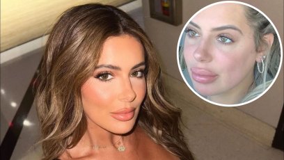 Brielle Biermann’s Plastic Surgery Transformation: Photos