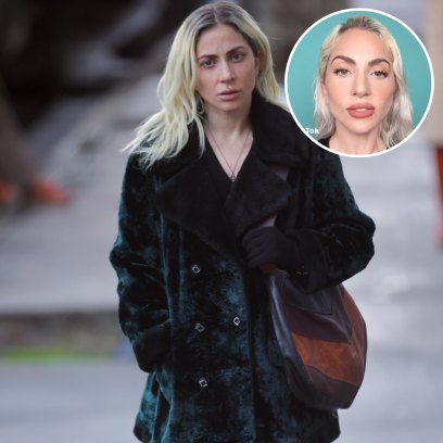 Did Lady Gaga Get Plastic Surgery? Everything the Singer-Actress Has Admitted to Over the Years