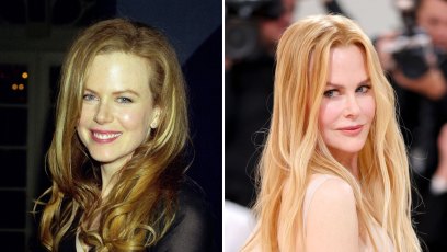 Did Nicole Kidman Have Plastic Surgery? See Transformation
