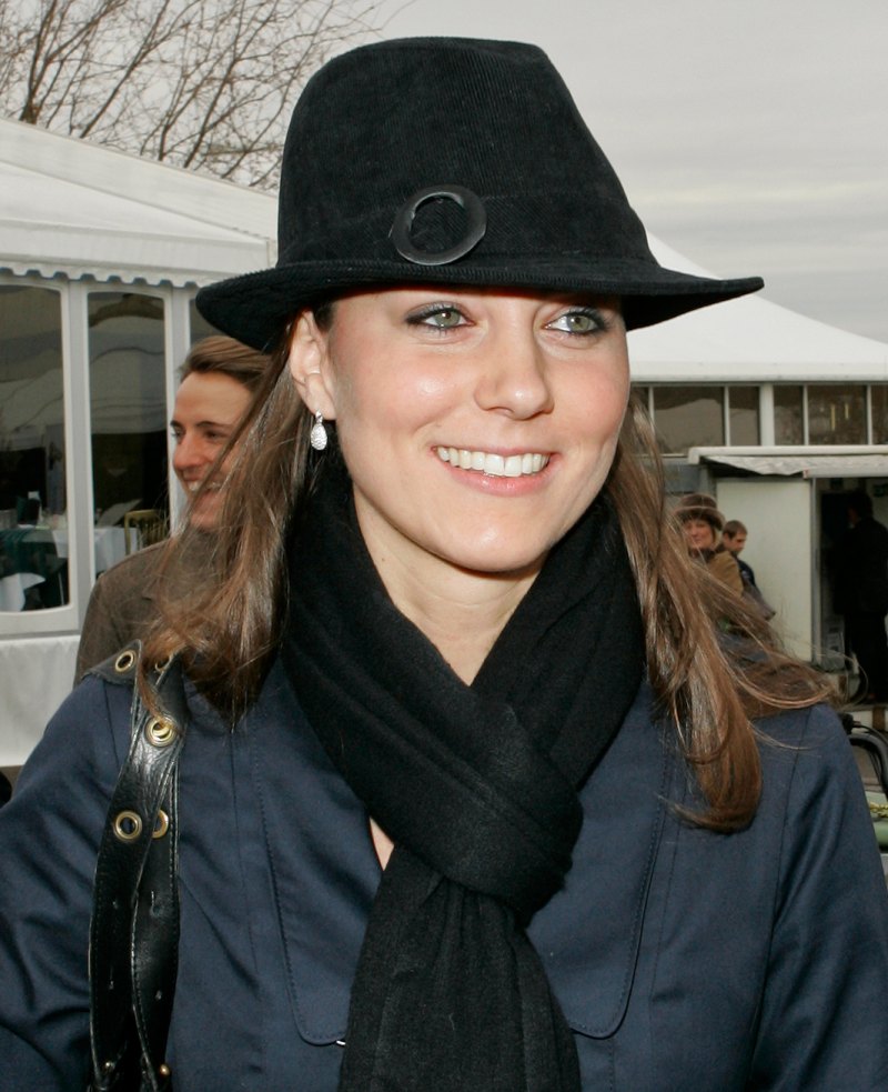 kate-middleton-plastic-surgery