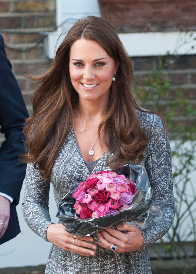 kate-middleton-plastic-surgery