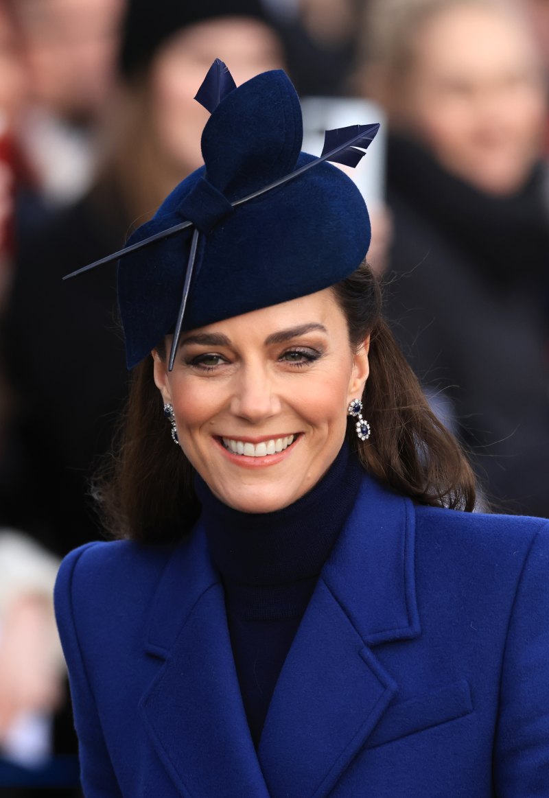 kate-middleton-plastic-surgery