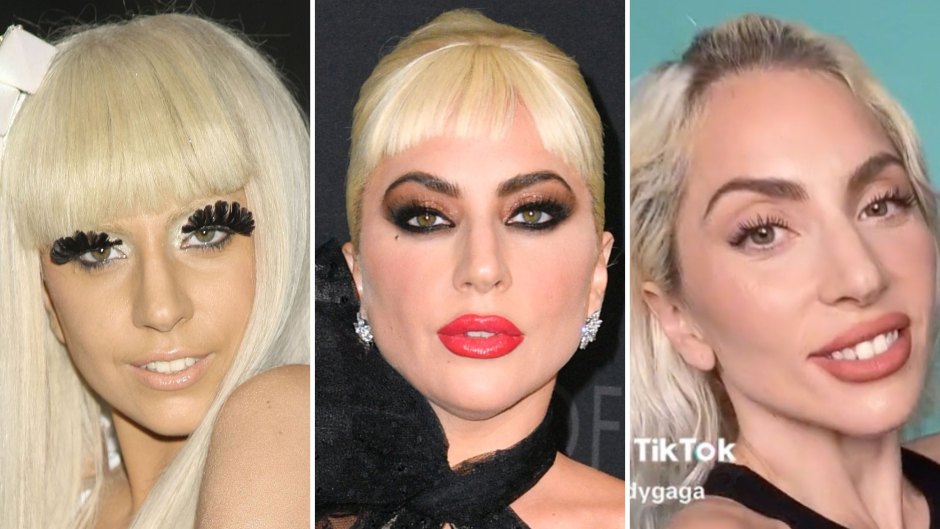 Lady Gaga Weight Loss Transformation: Before, After Photos