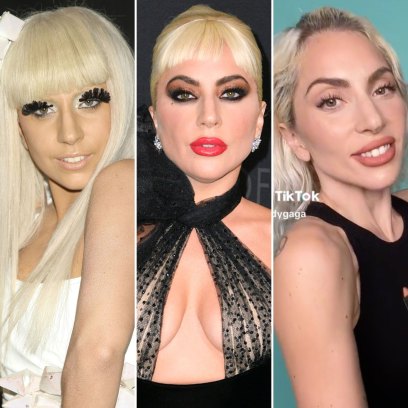 Lady Gaga Weight Loss Transformation: Before, After Photos