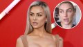 lala kent lip injections