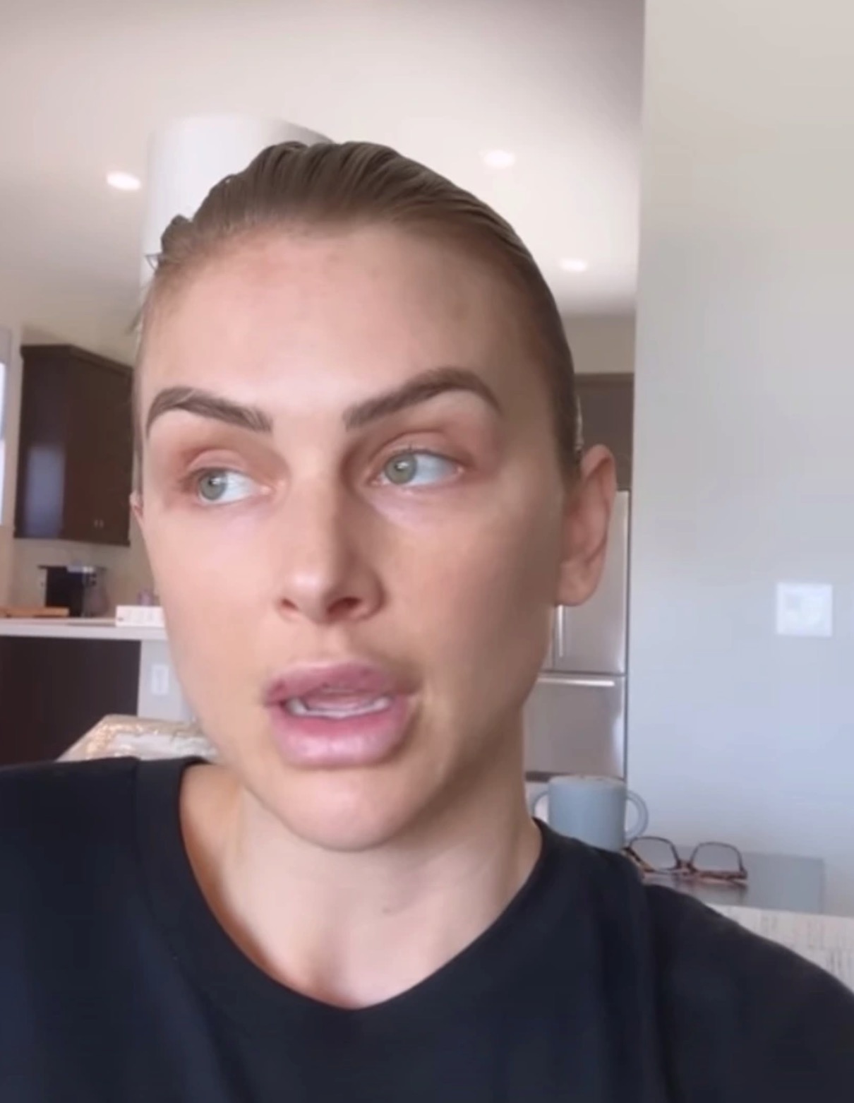 VPR's Lala Kent Lip Injections: Bruised, Swollen Photos | Life & Style