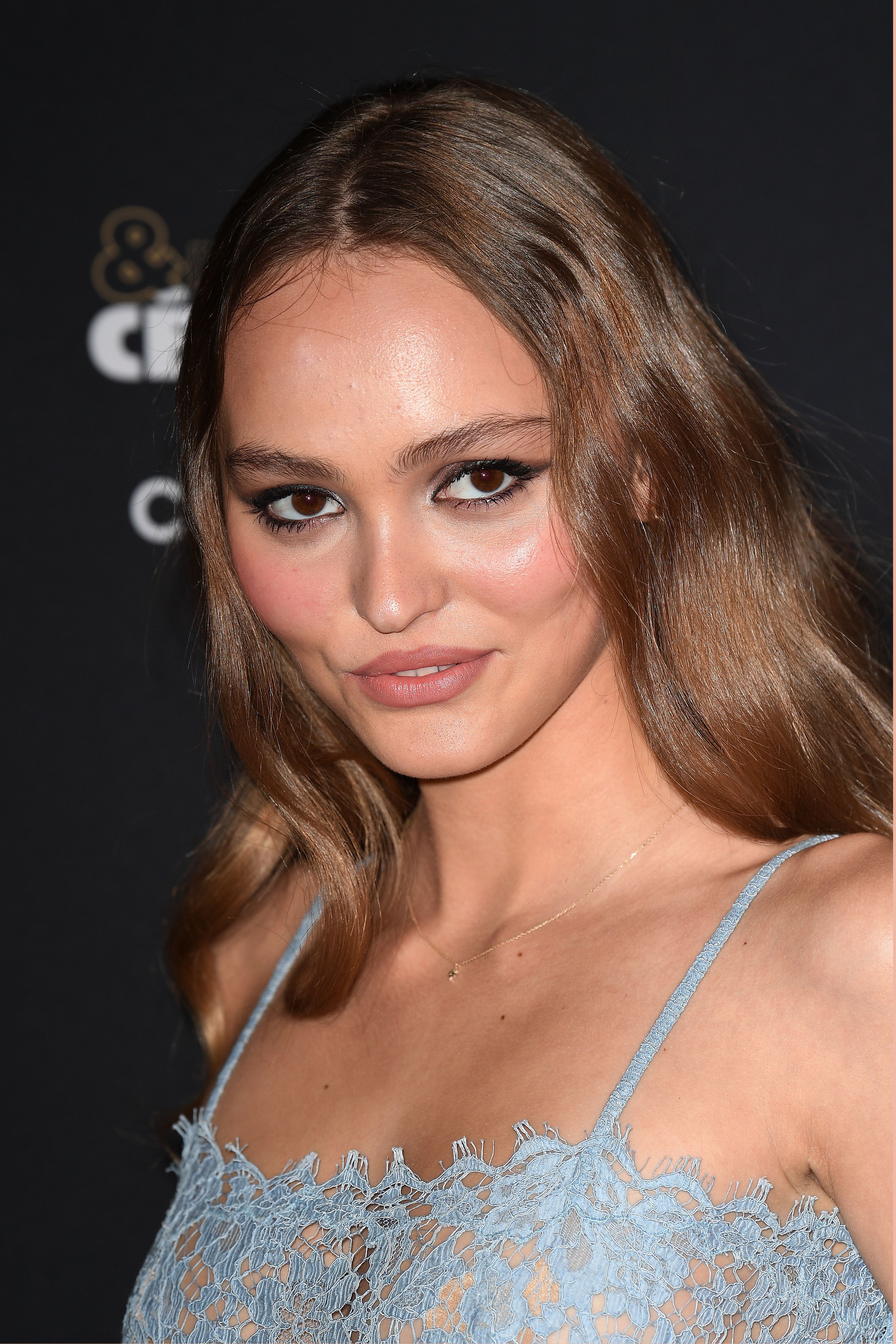 Lily-Rose Depp Plastic Surgery