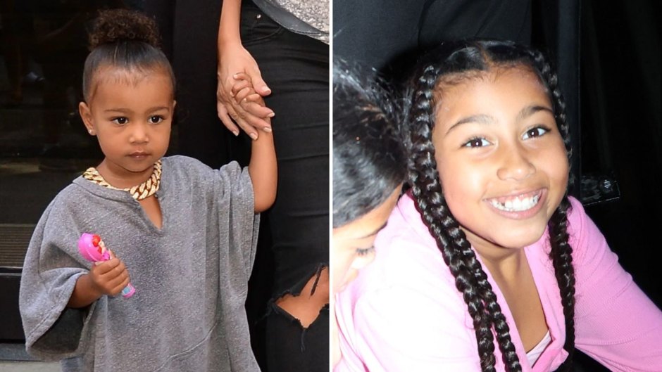 North West Transformation Photos: Before and After Pictures