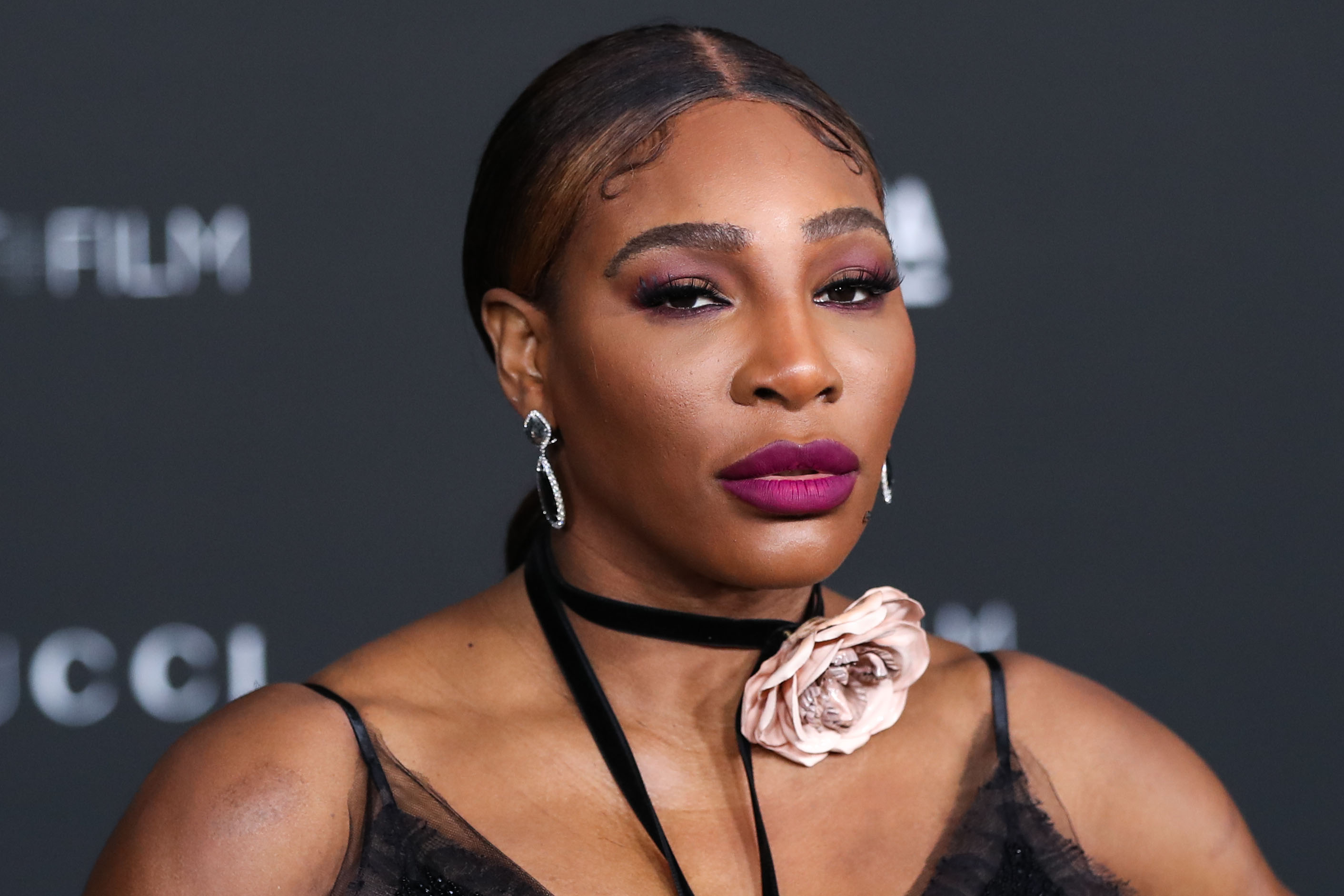Did Serena Williams Get Plastic Surgery? Before, After Photos