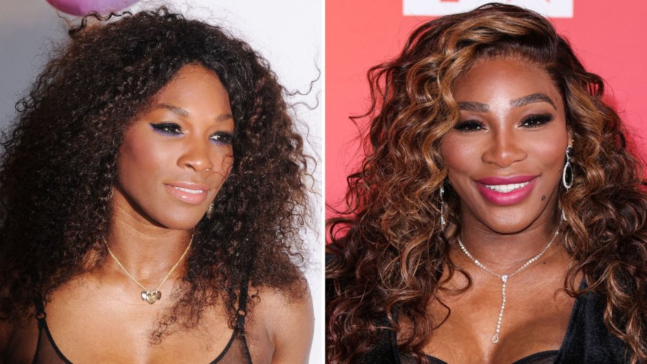 Did Serena Williams Get Plastic Surgery? Before, After Photos