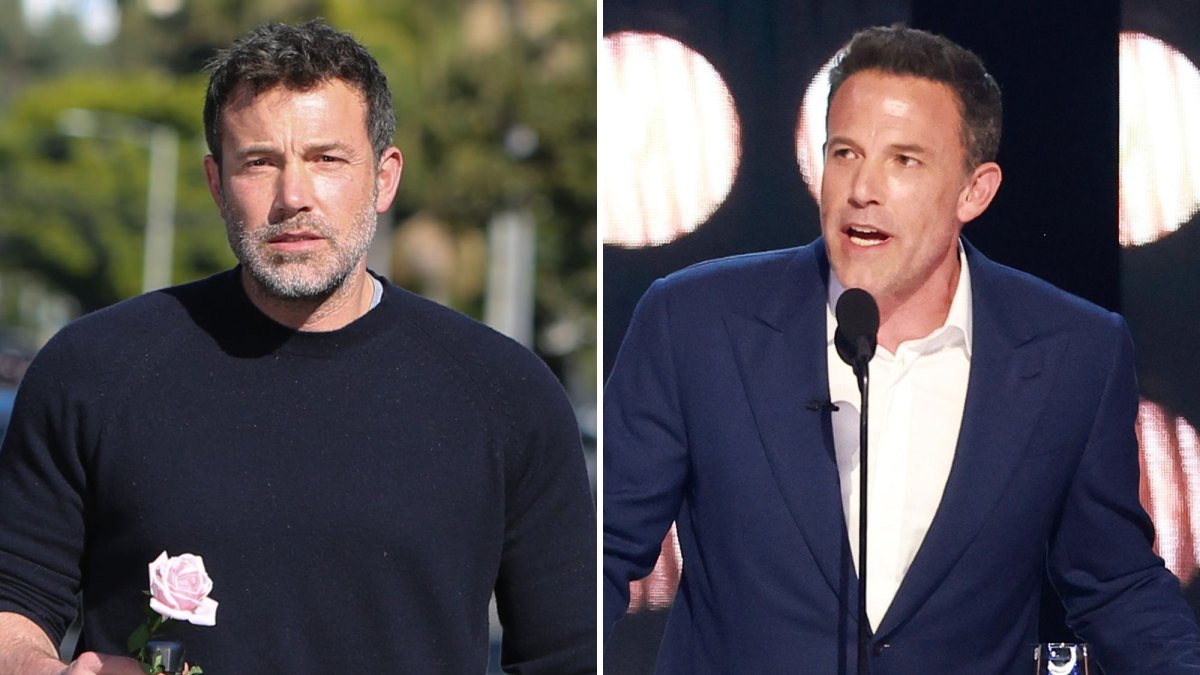 Has Ben Affleck Had Plastic Surgery? Transformation Photos
