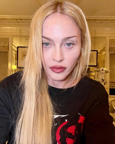 How Is Madonna Doing Update on Health and Condition