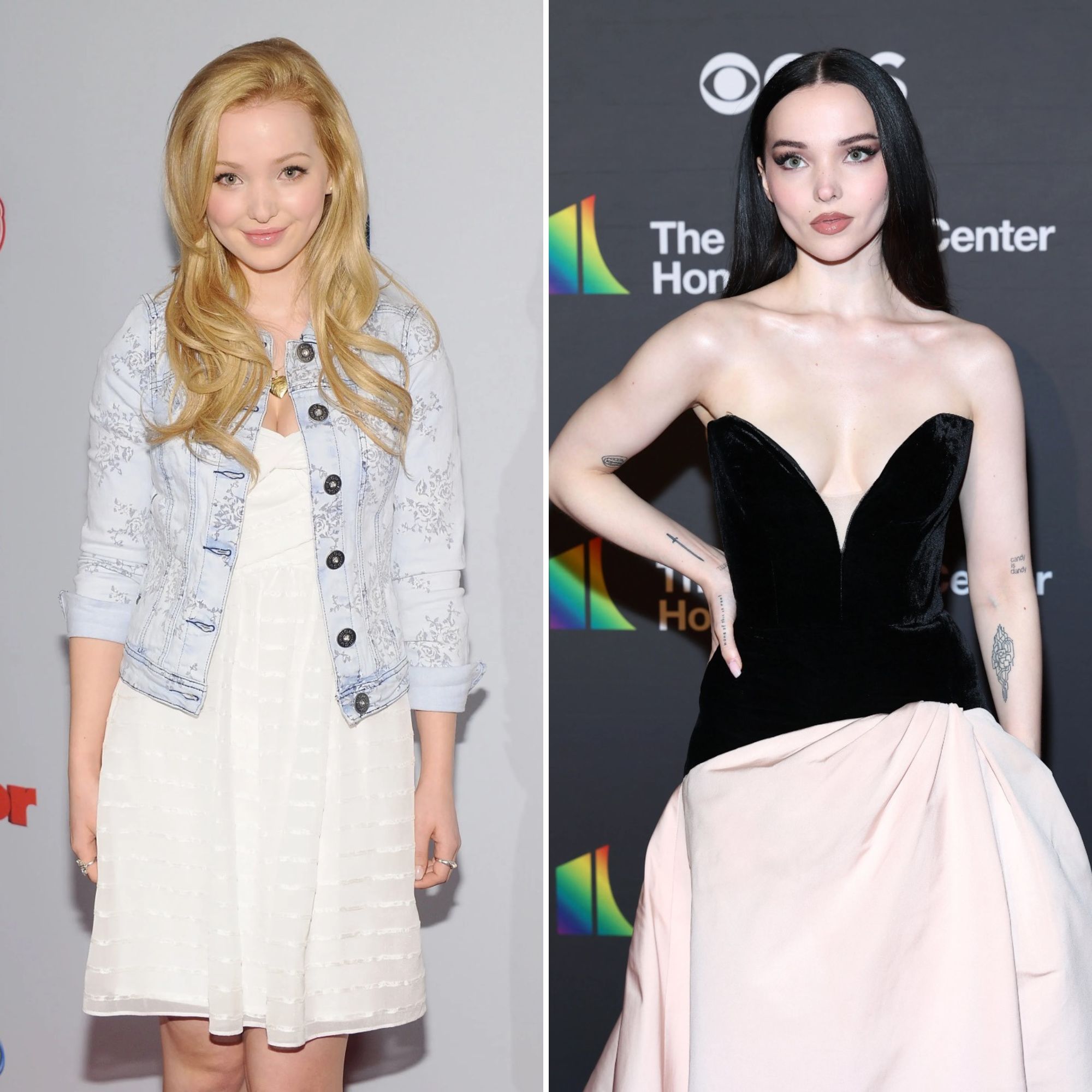 dove cameron plastic surgery