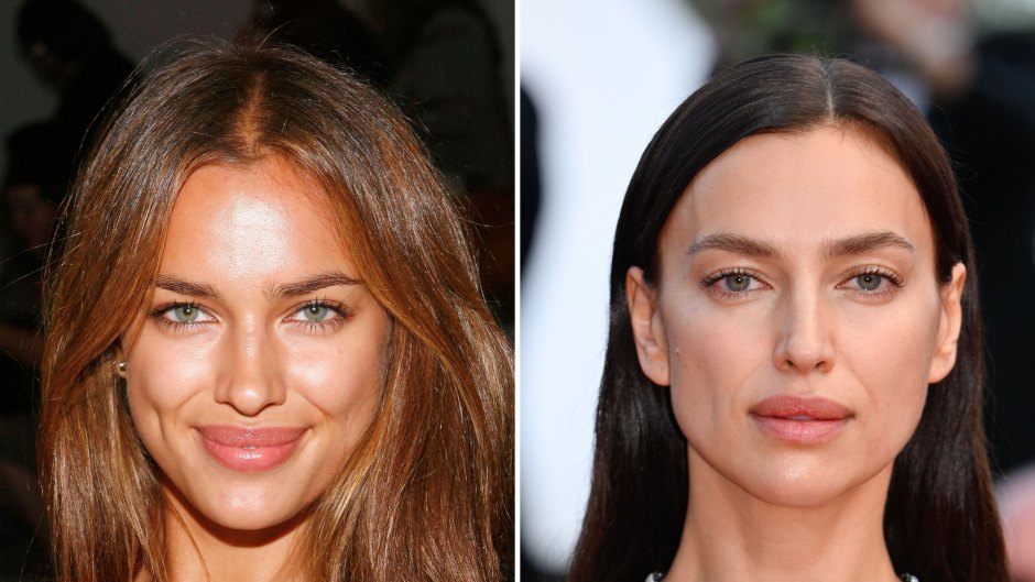 Did Irina Shayk Get Plastic Surgery? Then, Now Photos and Quotes