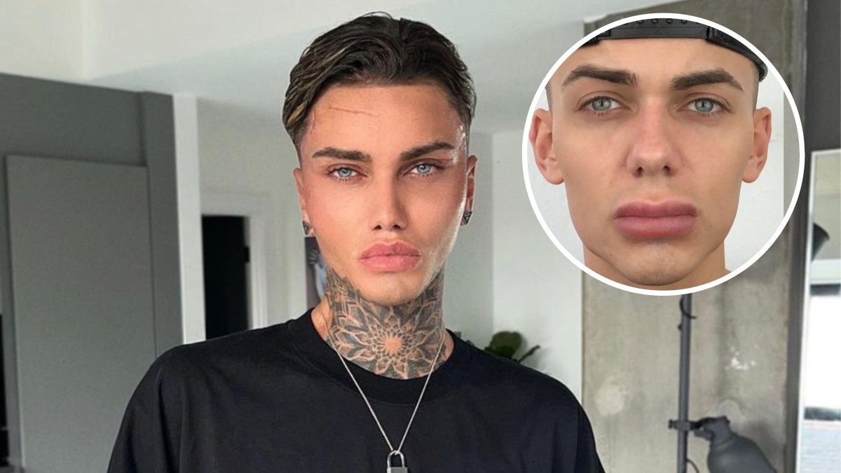 Levi Jed Murphy Plastic Surgery Transformation: Before, After Photos