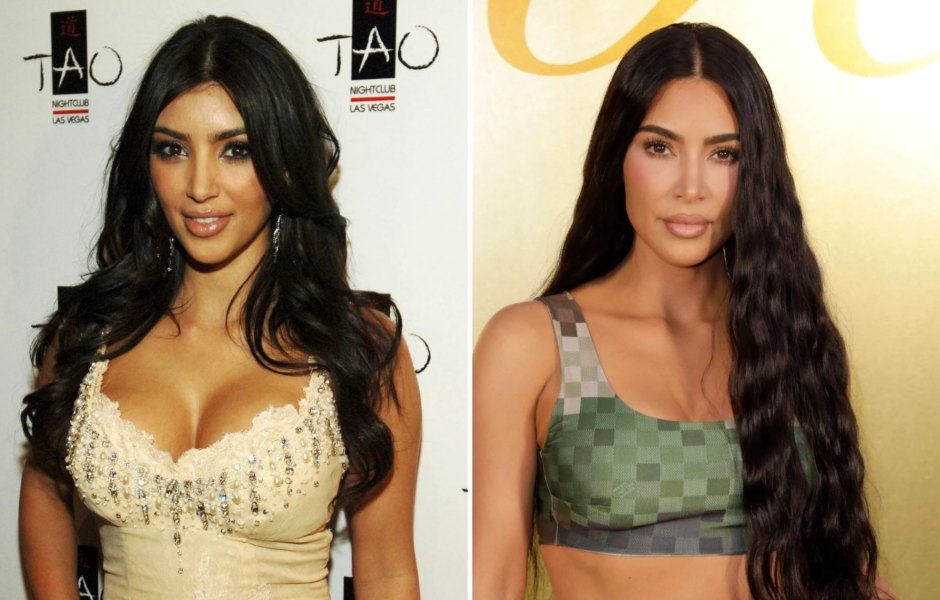 kim-kardashian-plastic-surgery-confessions