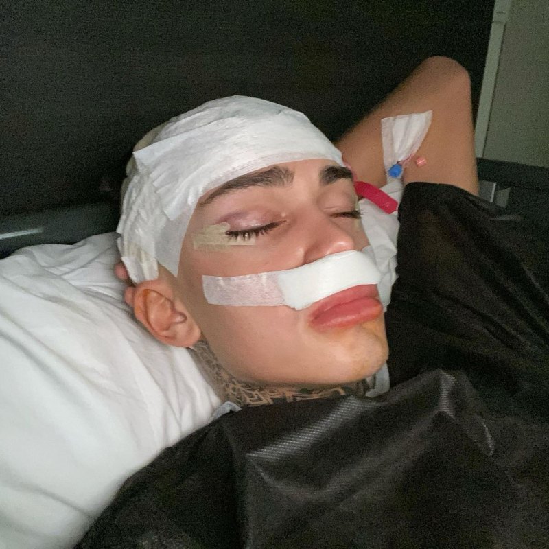 Levi Jed Murphy Plastic Surgery Transformation: Before, After Photos