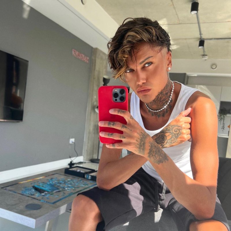 Levi Jed Murphy Plastic Surgery Transformation: Before, After Photos