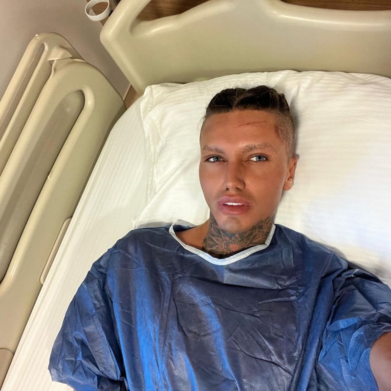 Levi Jed Murphy Plastic Surgery Transformation: Before, After Photos