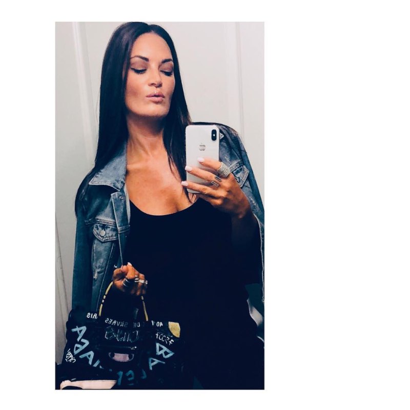 Did RHOSLC's Lisa Barlow Get Plastic Surgery? Then, Now Photos