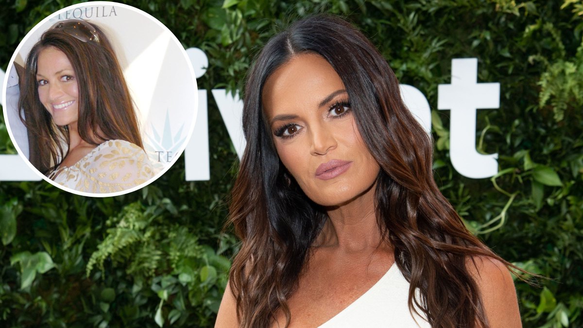 Did RHOSLC's Lisa Barlow Get Plastic Surgery? Then, Now Photos