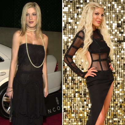 Tori Spelling Plastic Surgery Transformation: Before, After Photos
