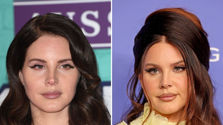 Did Lana Del Rey Get Plastic Surgery? Then and Now Photos