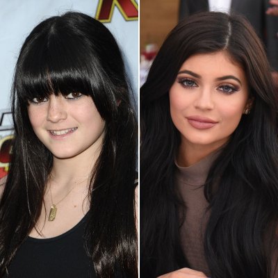 Kylie Jenner Says She 'Never Touched' Her Face Despite Plastic Surgery Past