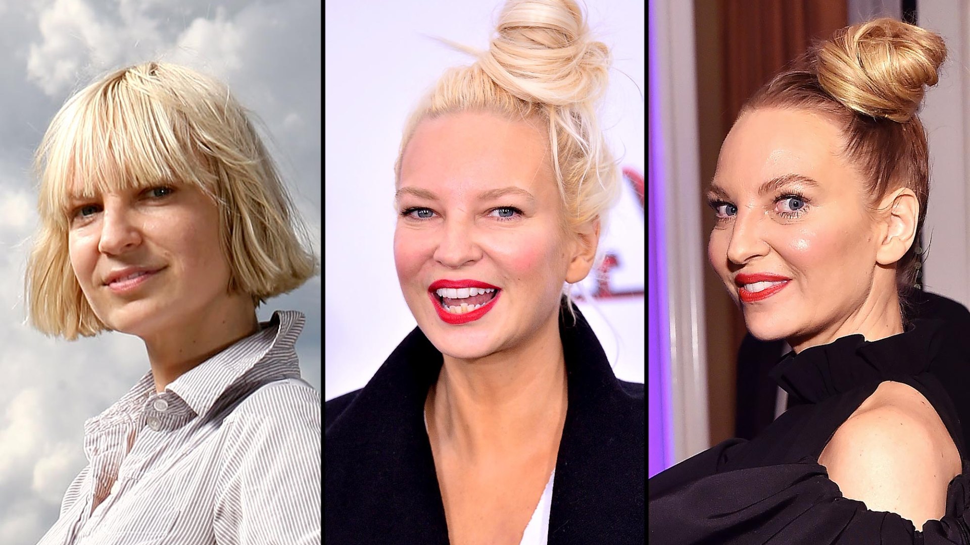 Sia Plastic Surgery Before and After Transformation Photos | Life & Style