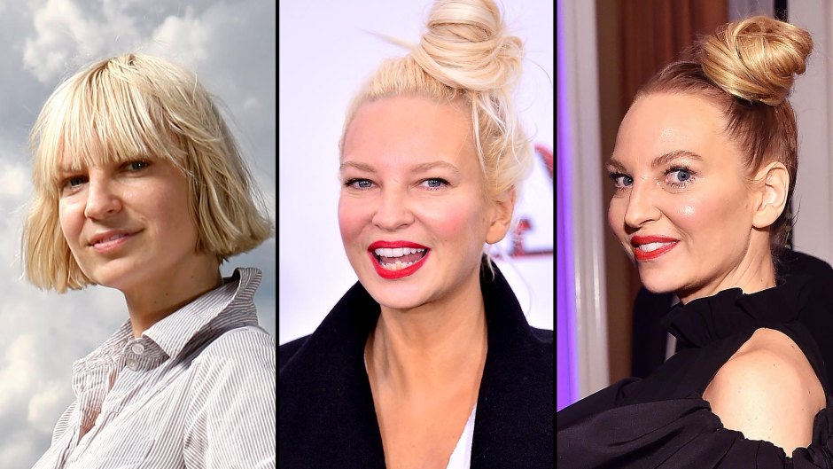 Sia Before and After Photos feature