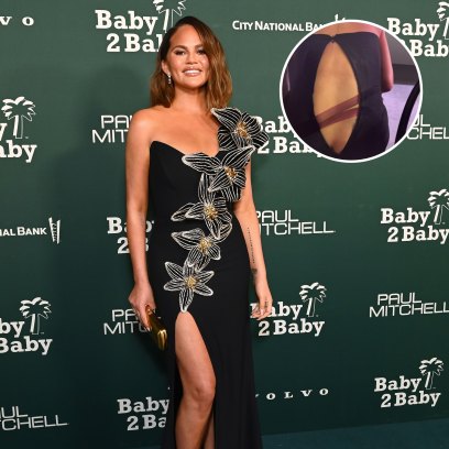Chrissy Teigen Suffers Major Wardrobe Malfunction at Baby2Baby Gala: Photo