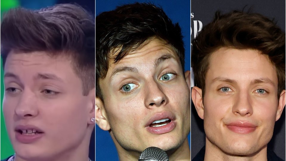 Problem Matt Rife Did Matt Rife Get Plastic Surgery? His Transformation Photos | Life & Style