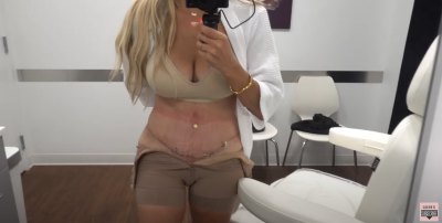 RHONJ’s Danielle Cabral's Tummy Tuck, Addresses Ozempic Remark