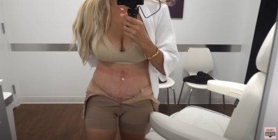 RHONJ&rsquo;s Danielle Cabral's Tummy Tuck, Addresses Ozempic Remark