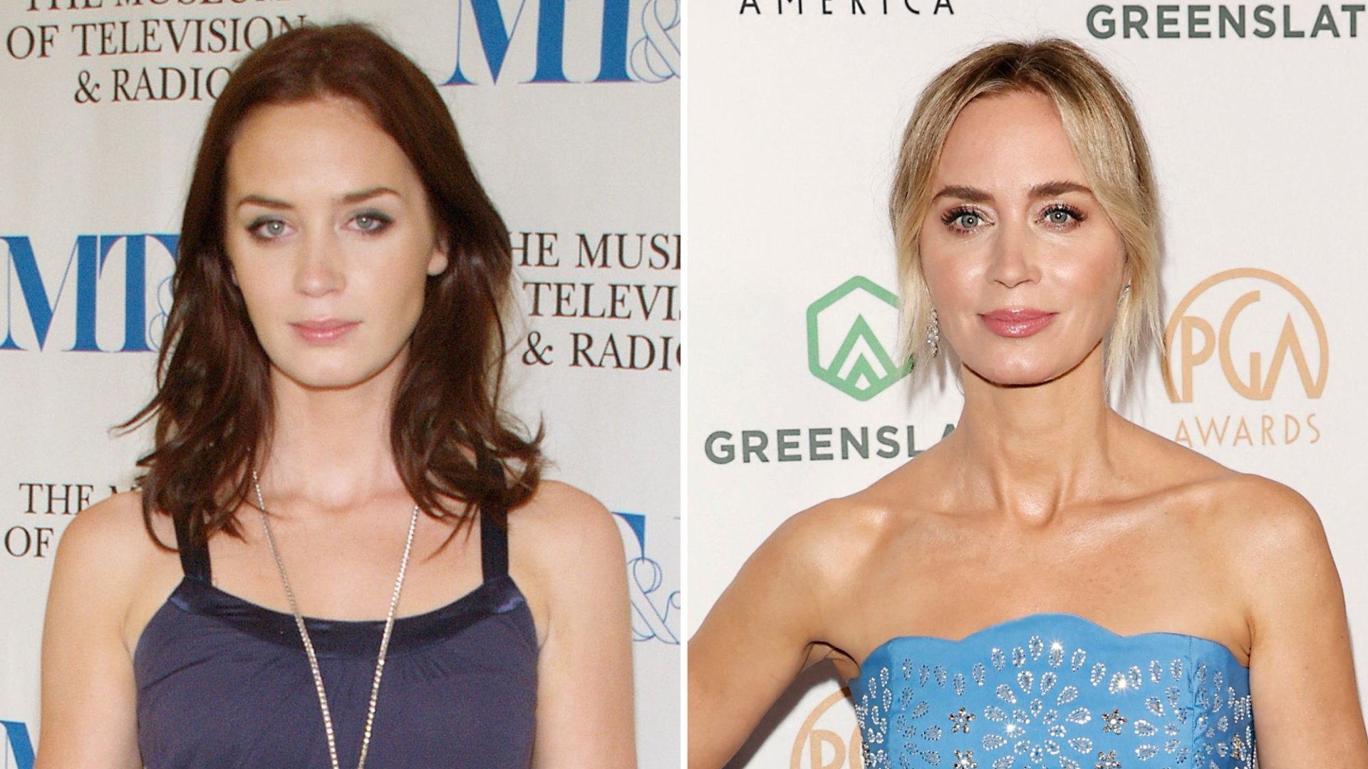 Has Emily Blunt Had Plastic Surgery Transformation Photos Life Style has-emily-blunt-had-plastic-surgery-transformation-photos-life-style